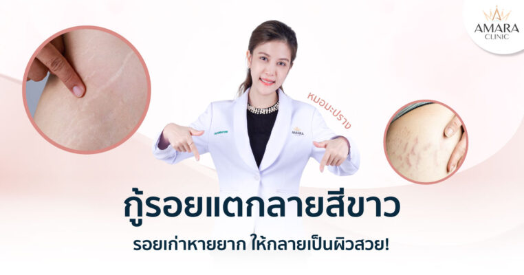 เคลียร์รอยแตกลายสีขาว หายยากแค่ไหนก็เอาอยู่!