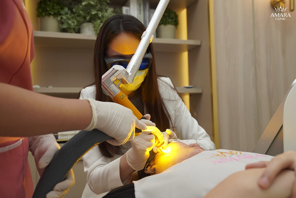 Treating Nose Acne by Pico Plus Laser